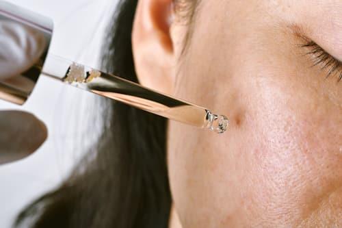 Infected Acne Treatment Plan (This One’s From Exposed)