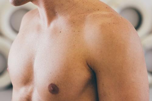 How To Get Rid Of Chest Acne Overnight (Exposed Does It Fast)