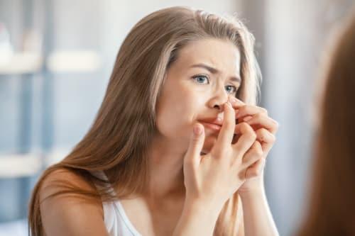 What Makes Acne Worse? (Exposed Helps Reverse It)