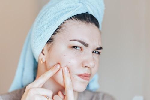 Nodule Acne Vs Cystic Acne? (Clear Both With Exposed)
