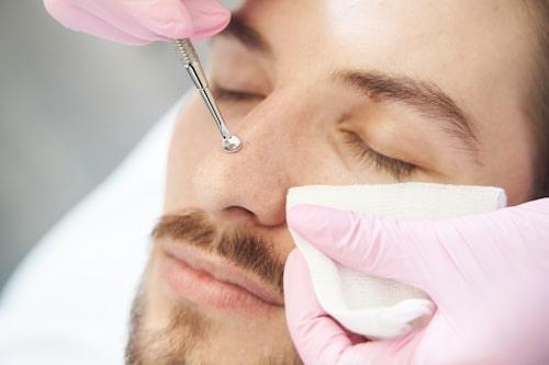 How to Use Acne Tools (Tips and Tricks You Need to Know)